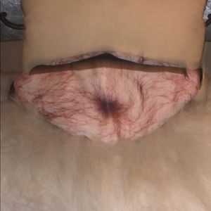 Belly Button Fat Gut Fanny Pack